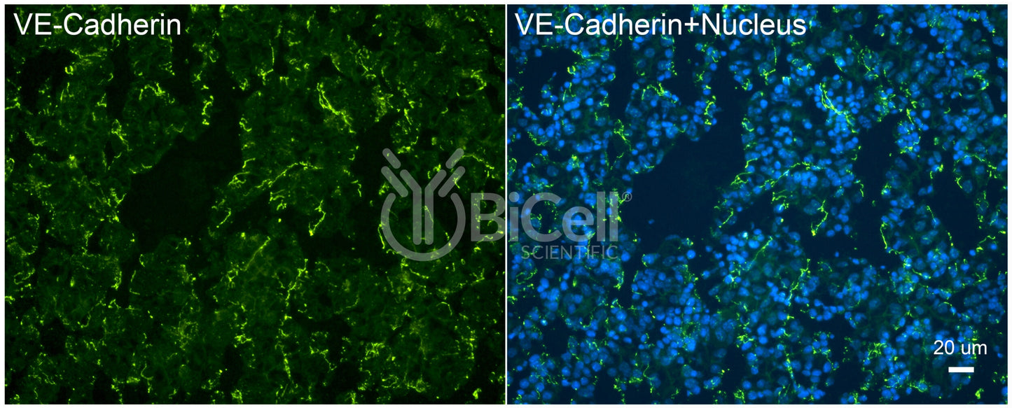 VE-cadherin (Cdh5 or Cadherin-5 or CD144) Antibody - Western Blot Validated