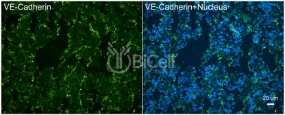 VE-cadherin (Cdh5 or Cadherin-5 or CD144) Antibody - Western Blot Validated