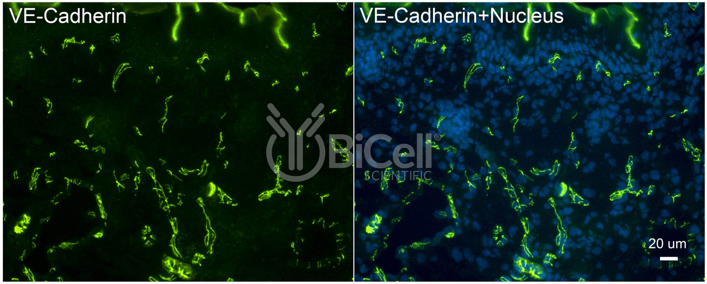 VE-cadherin (Cdh5 or Cadherin-5 or CD144) Antibody - FFPE Validated