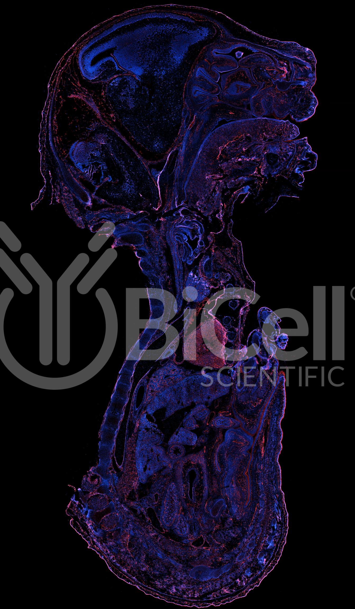 VE-cadherin (Cdh5 or Cadherin-5 or CD144) Antibody - FFPE Validated