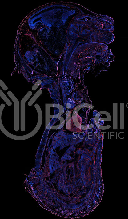 VE-cadherin (Cdh5 or Cadherin-5 or CD144) Antibody - FFPE Validated