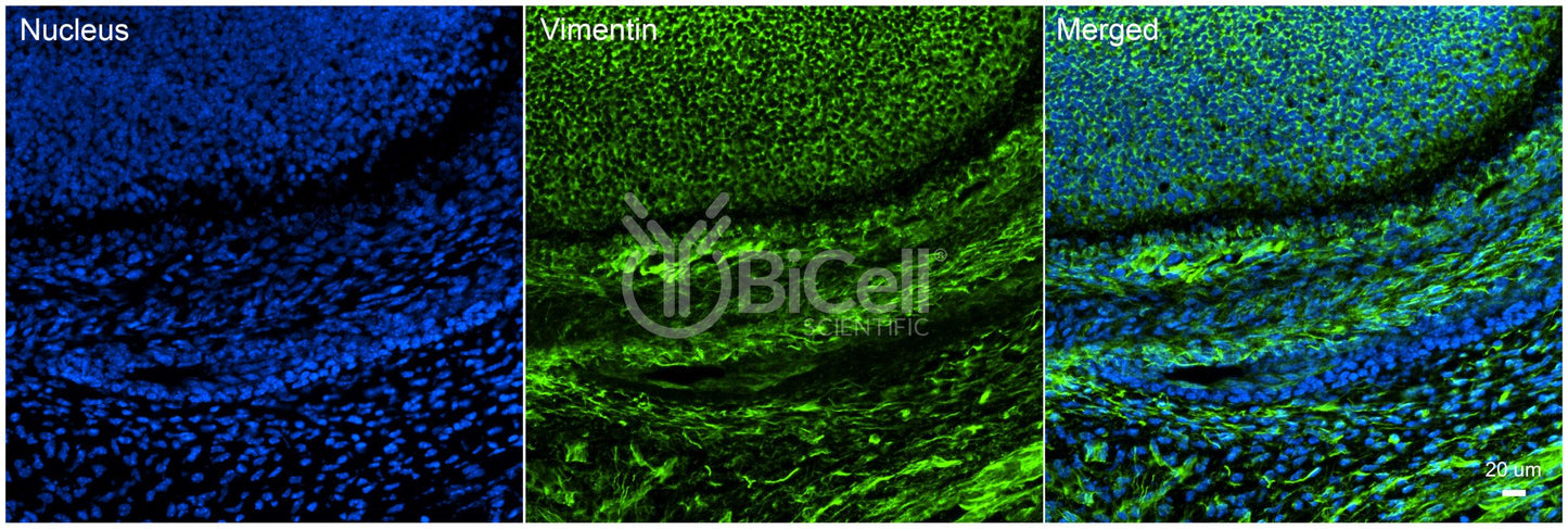 Vimentin (VIM) Antibody - Western Blot Validated