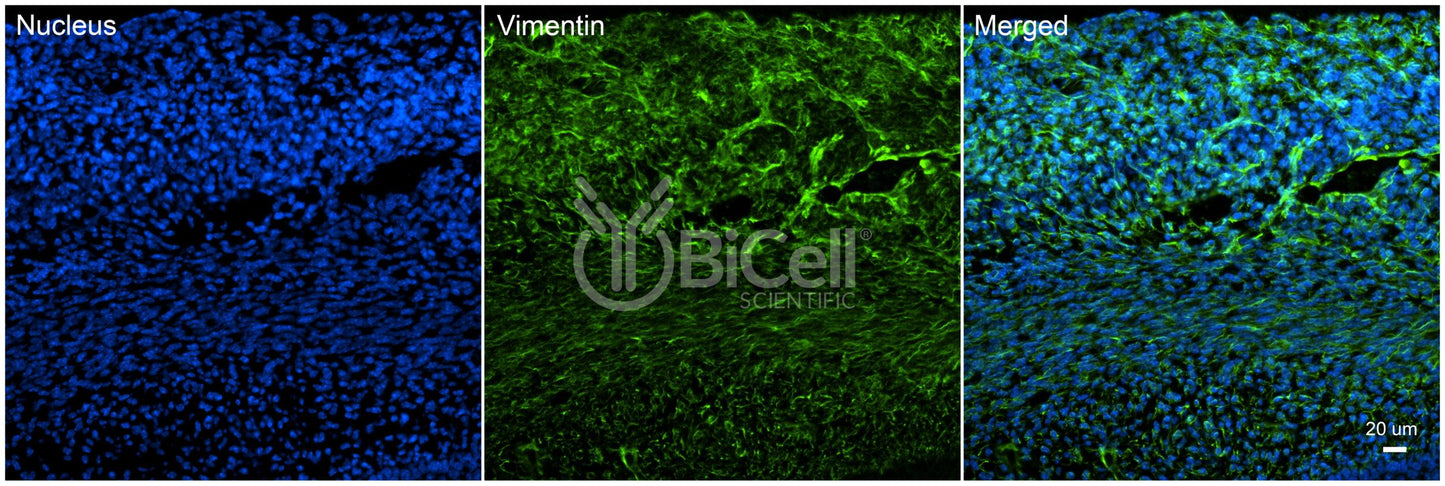 Vimentin (VIM) Antibody - Western Blot Validated
