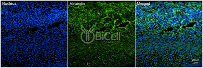 Vimentin (VIM) Antibody
