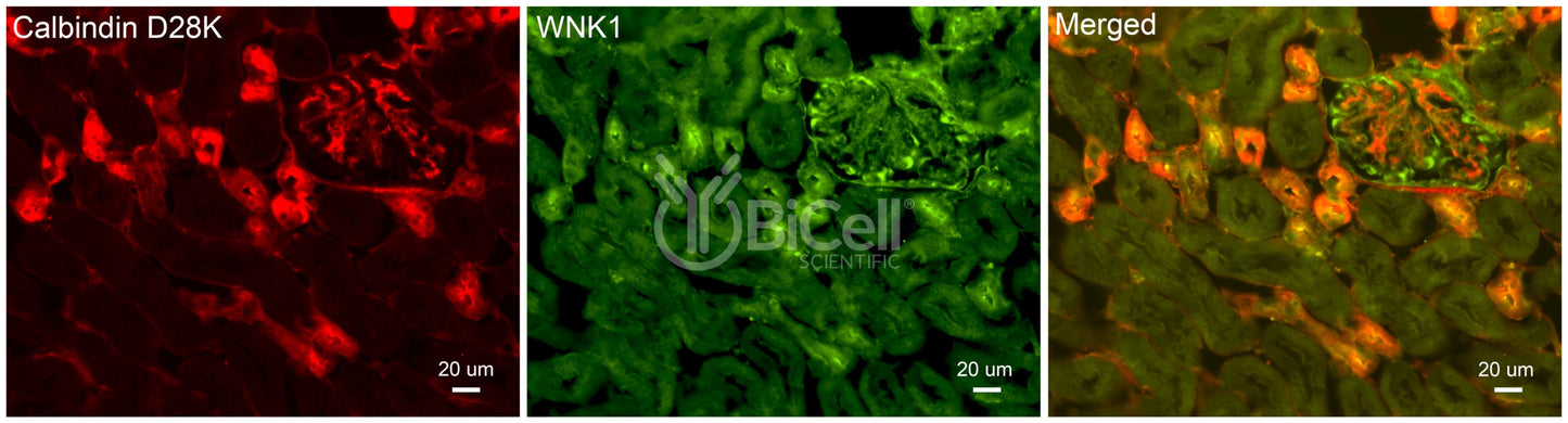 WNK1 Antibody - FFPE Validated