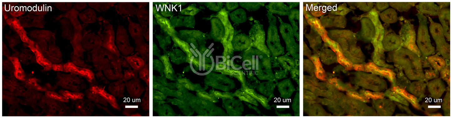 WNK1 Antibody - FFPE Validated