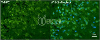 WNK2 Antibody