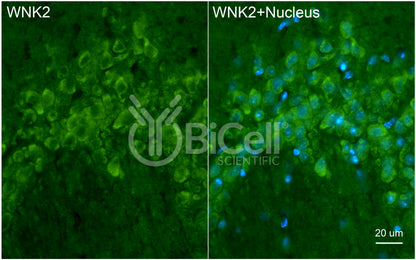 WNK2 Antibody - Western Blot Validated