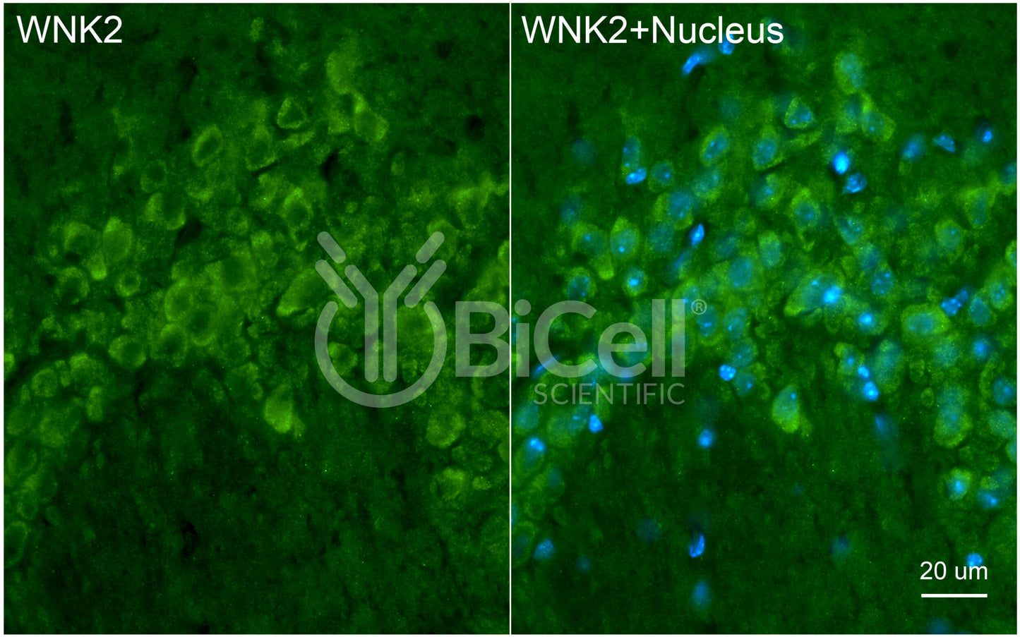 WNK2 Antibody