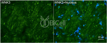 WNK3 Antibody - FFPE Validated