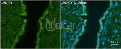 WNK3 Antibody - Western Blot Validated