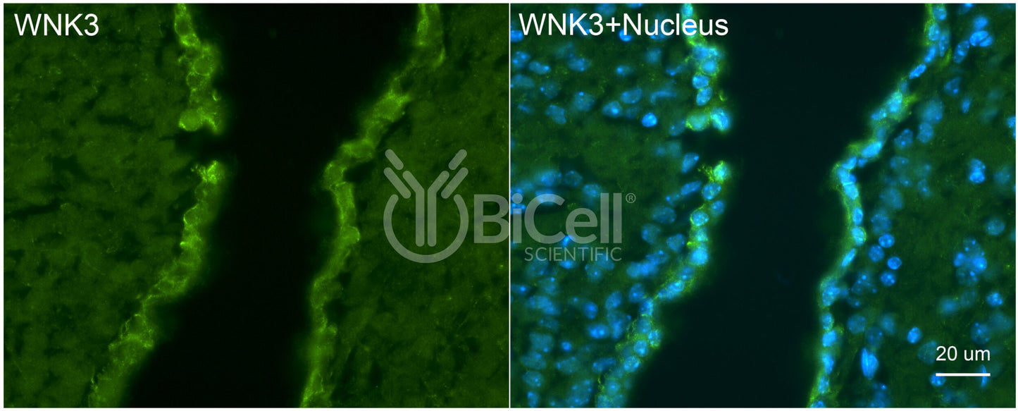 WNK3 Antibody - FFPE Validated