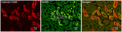 WNK4 Antibody - Western Blot Validated