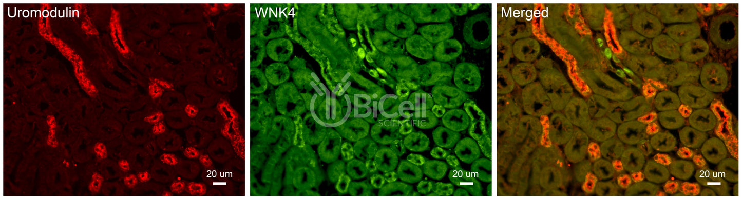 WNK4 Antibody - Western Blot Validated