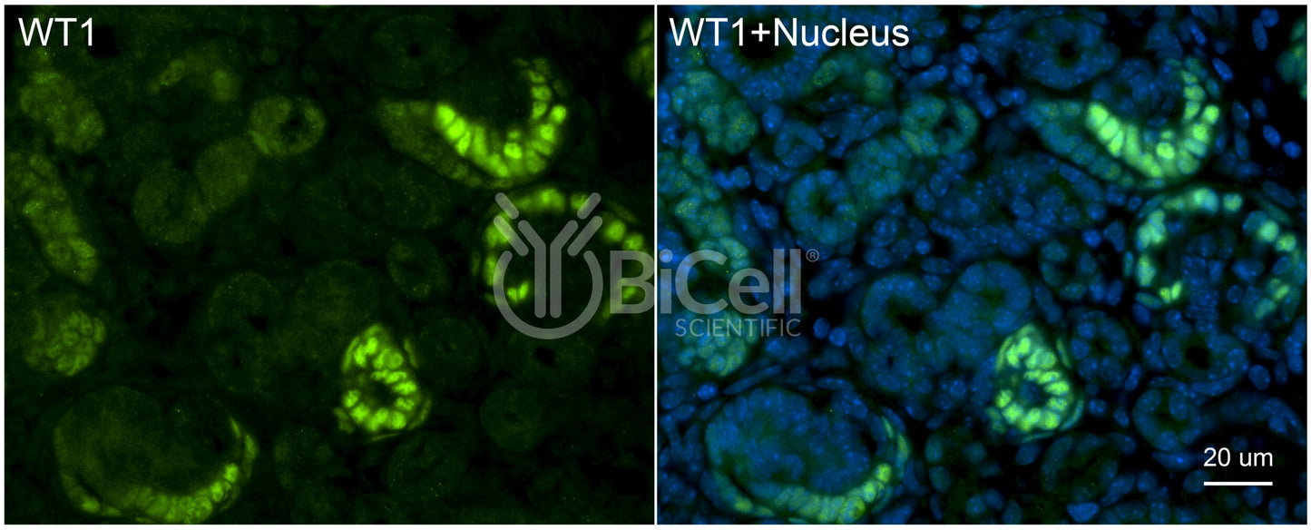 WT1 Antibody