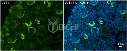 WT1 Antibody - FFPE Validated