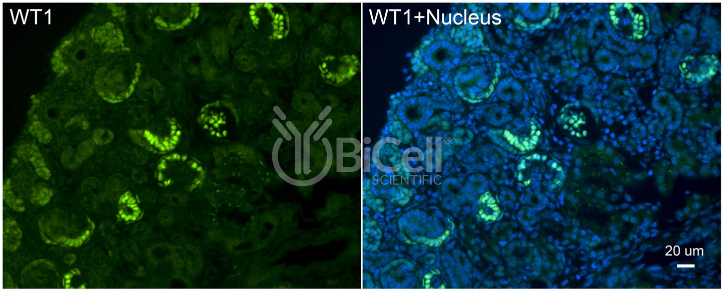 WT1 Antibody