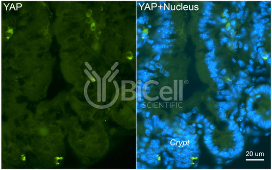 YAP (YAP1) Antibody - Western Blot Validated