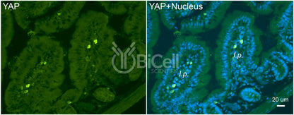 YAP (YAP1) Antibody - Western Blot Validated