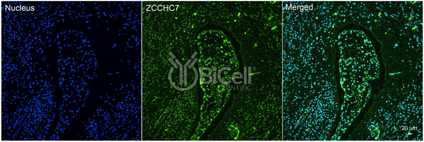 ZCCHC7 Antibody - Western Blot Validated
