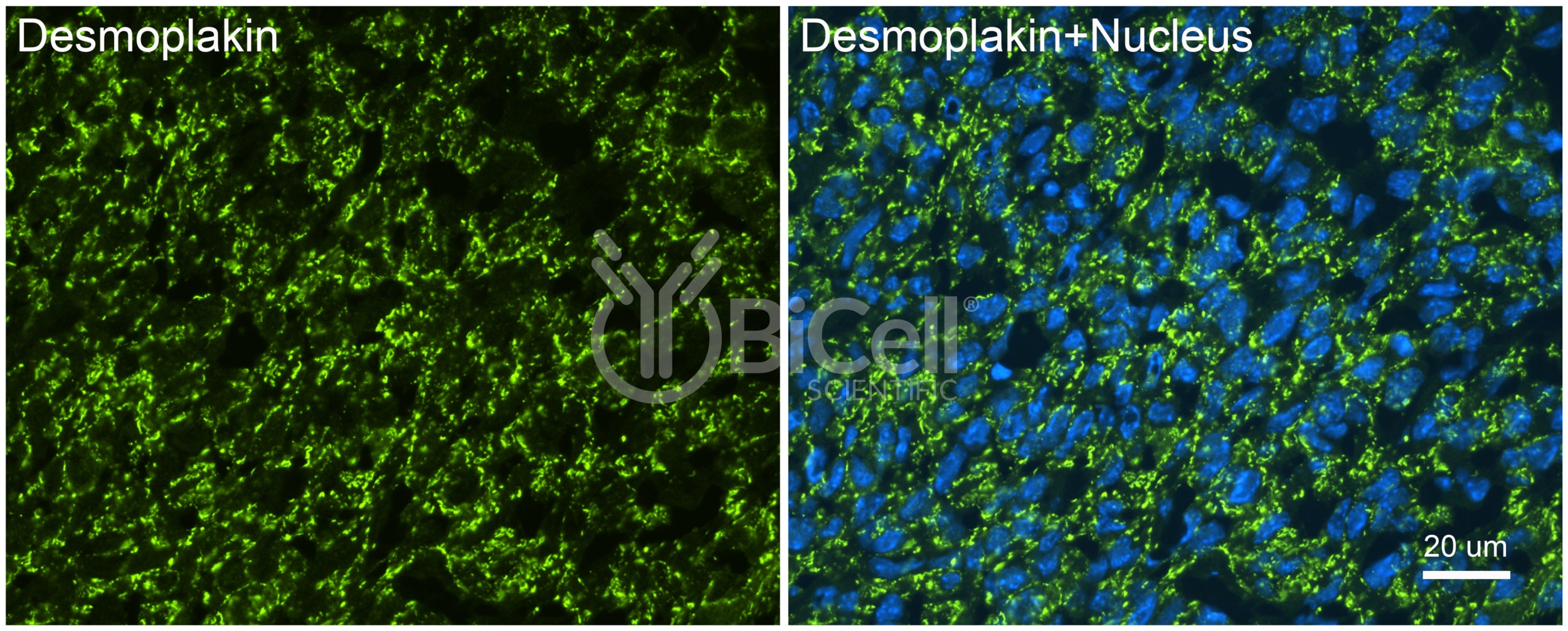 Desmoplakin (DSP) Antibody
