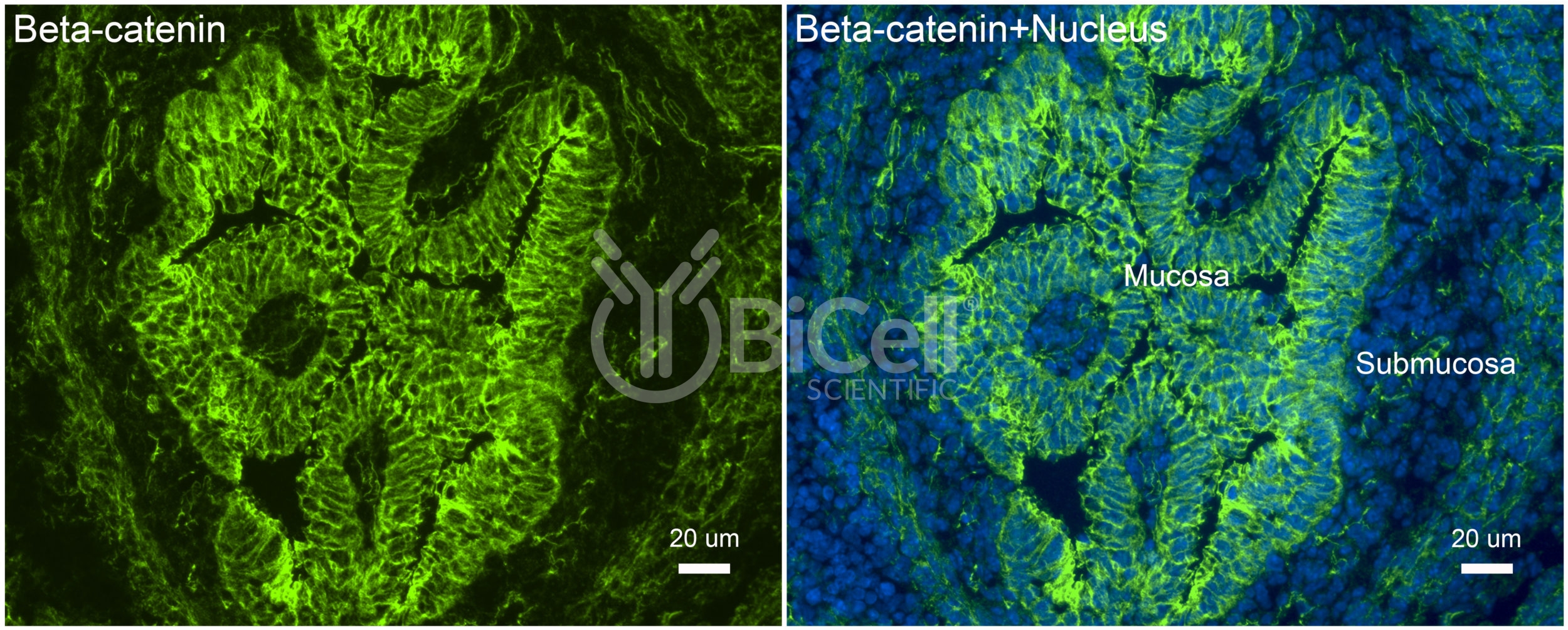 Beta-Catenin (Ctnnb1) Antibody