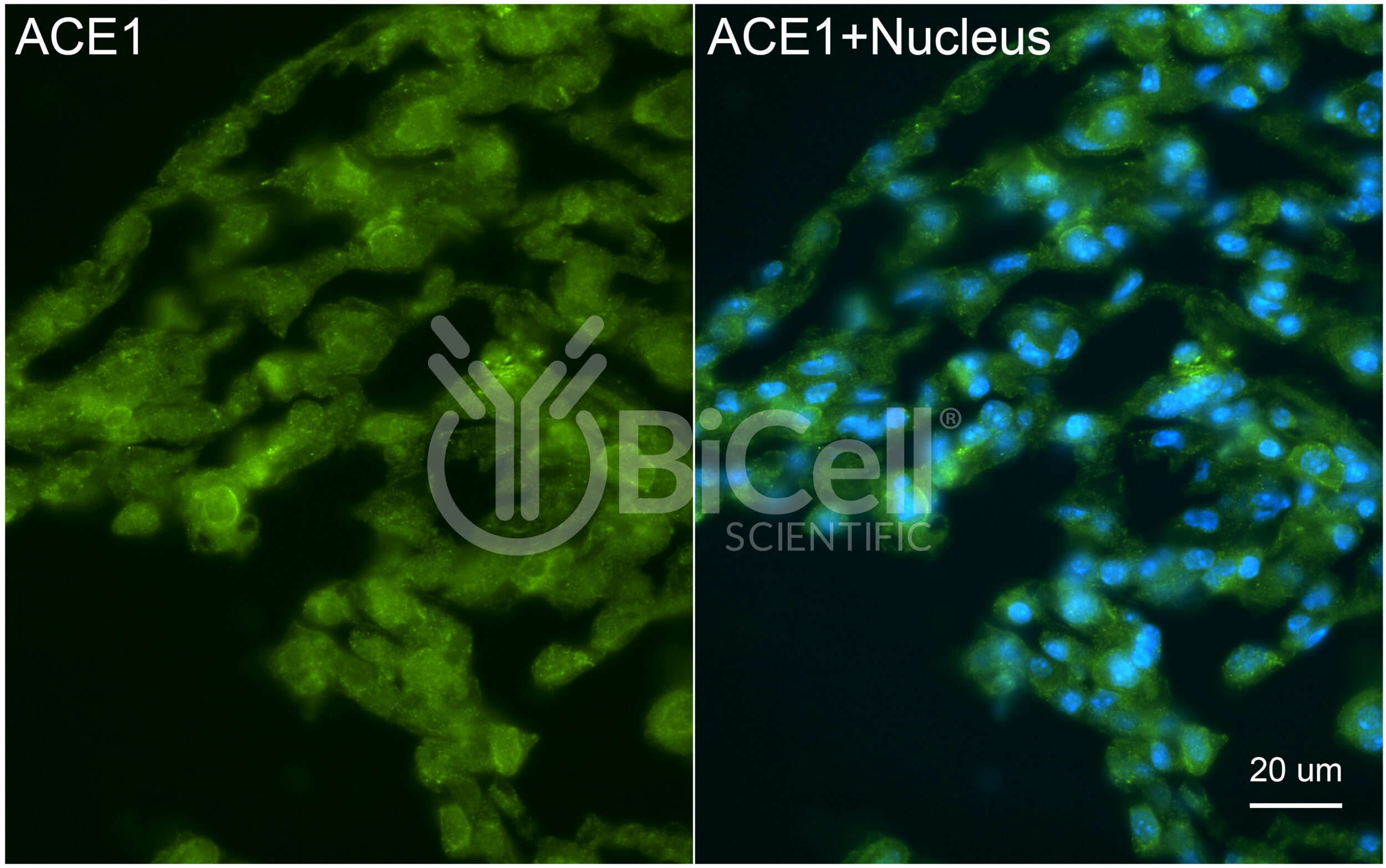 ACE1 (ACE or CD143) Antibody