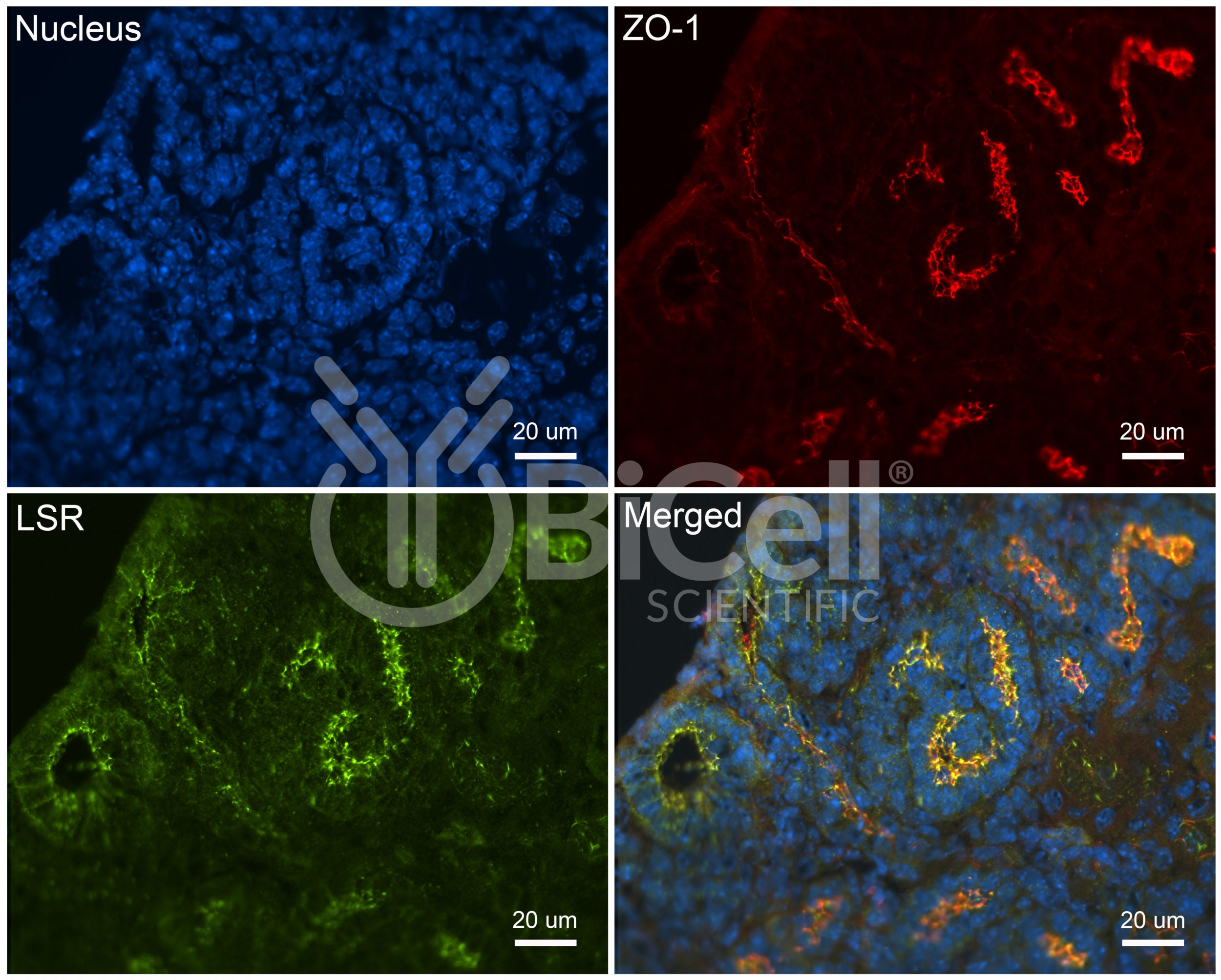 LSR (Angulin-1) Antibody