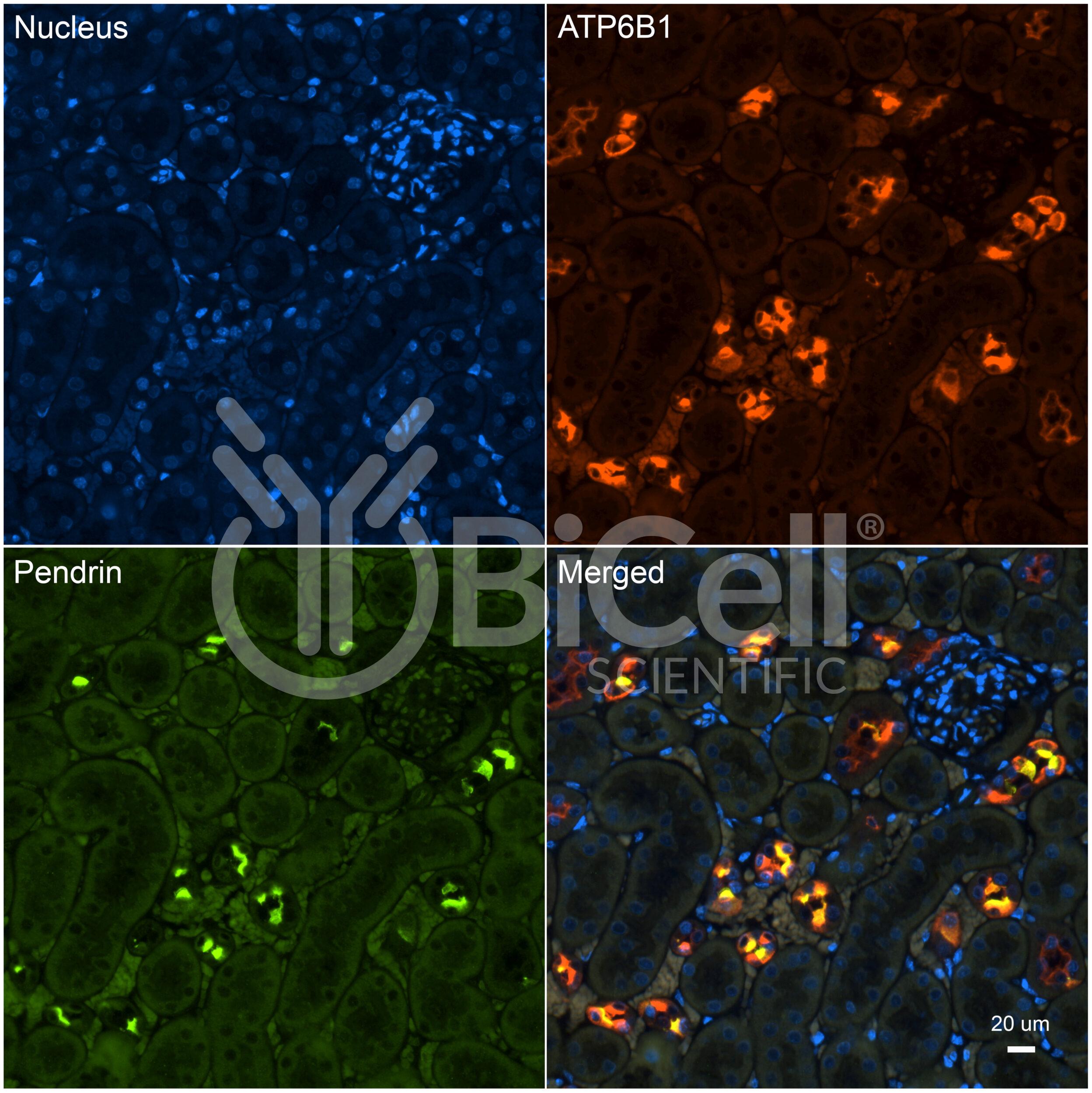 Pendrin (Slc26a4) Antibody