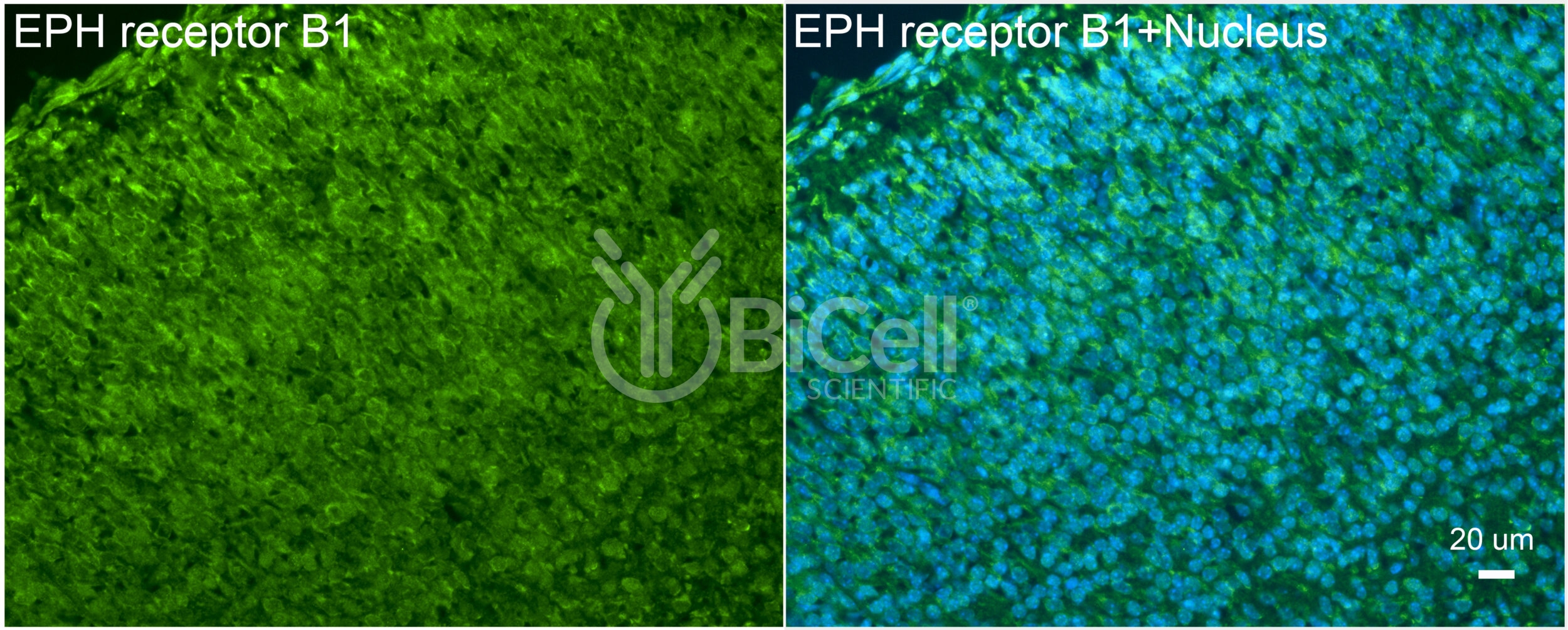 EPH Receptor B1 (EPHB1) Antibody