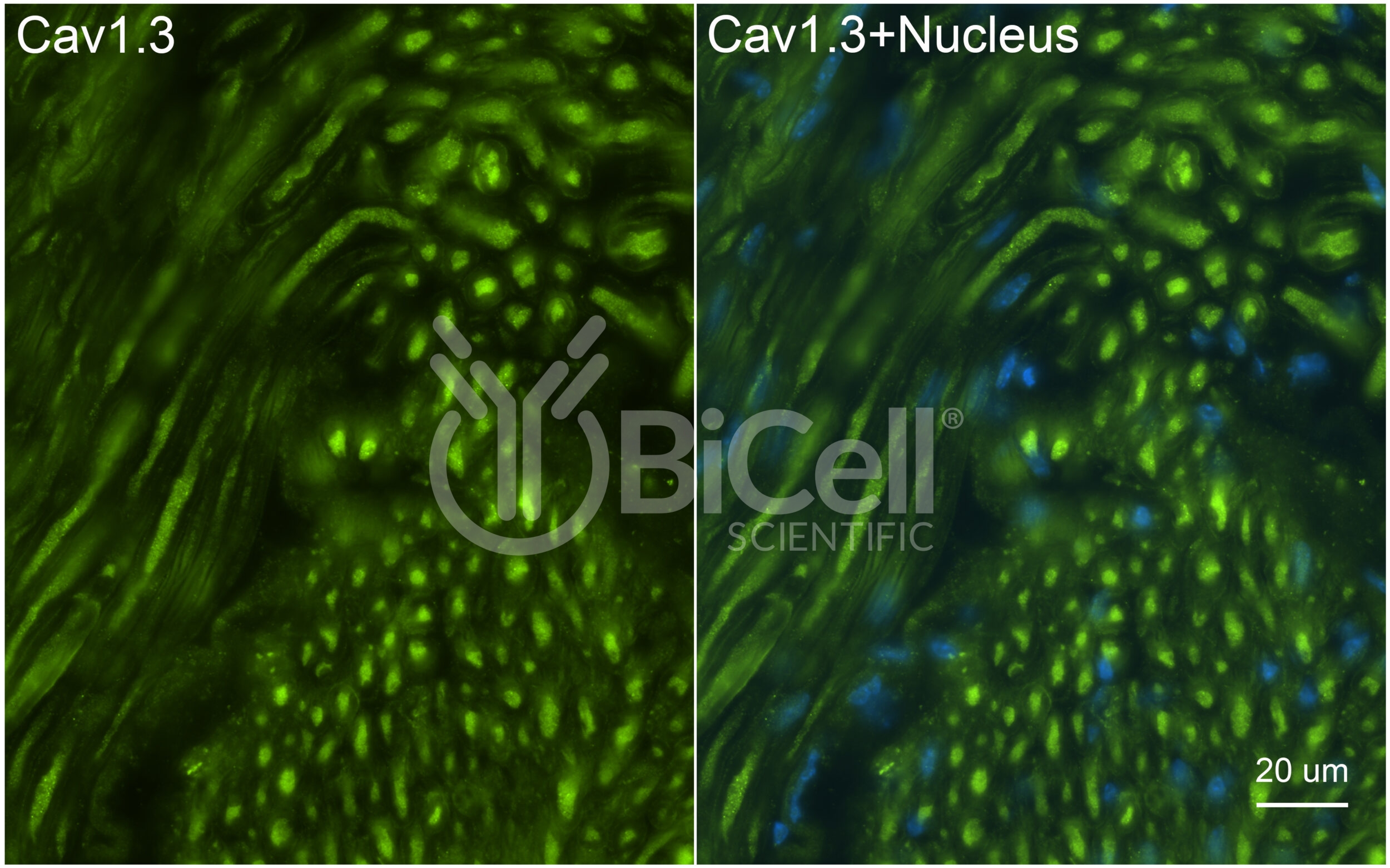 CACNA1D (Cav1.3) Antibody