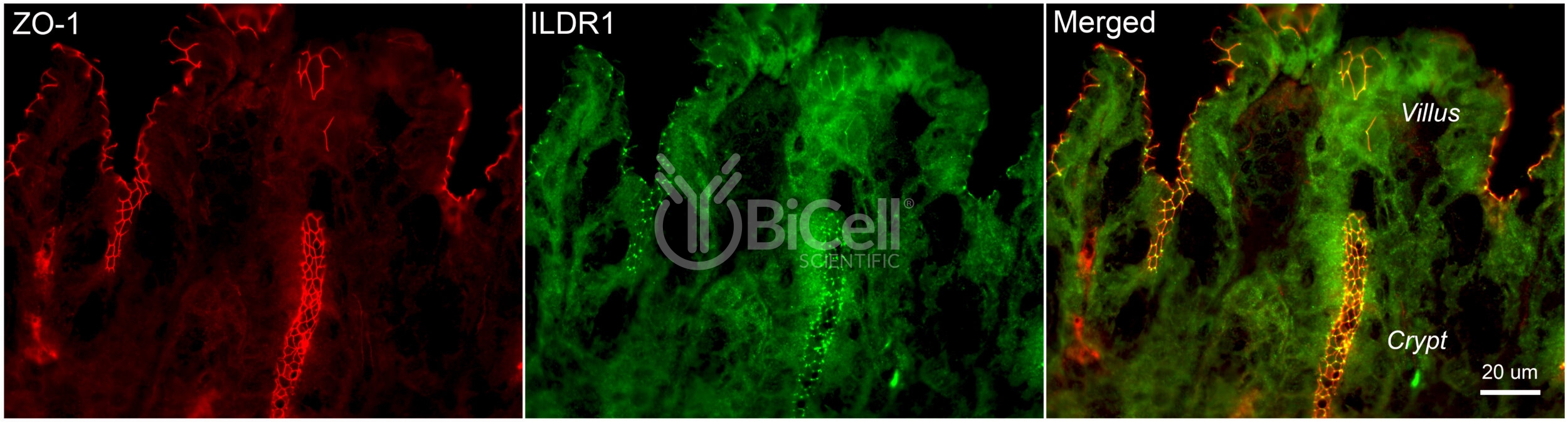 ILDR1 (Angulin-2) Antibody