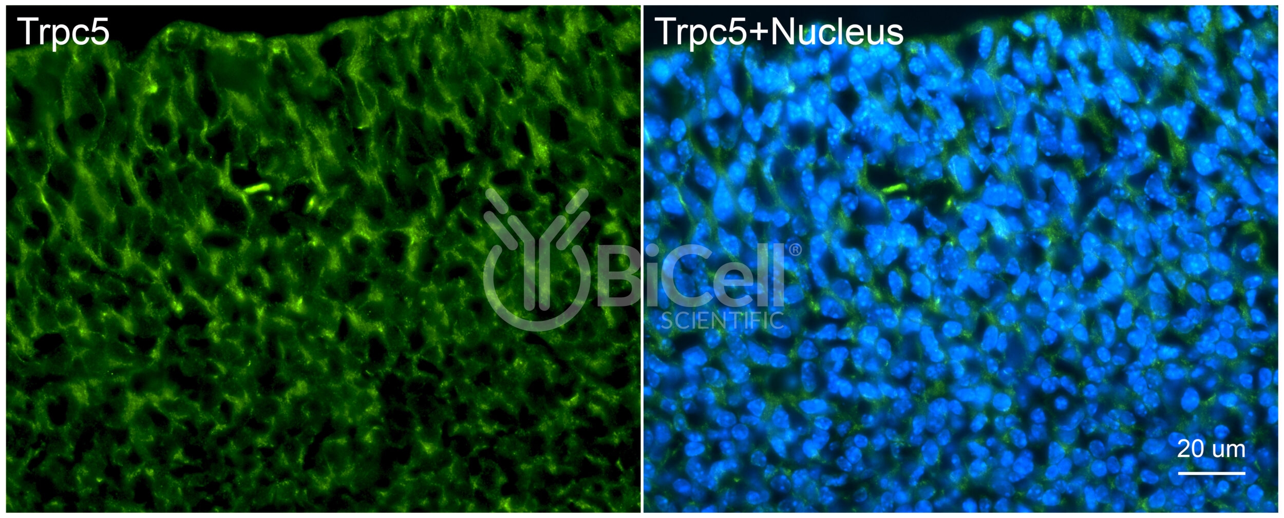 Trpc5 (C-Terminus) Antibody