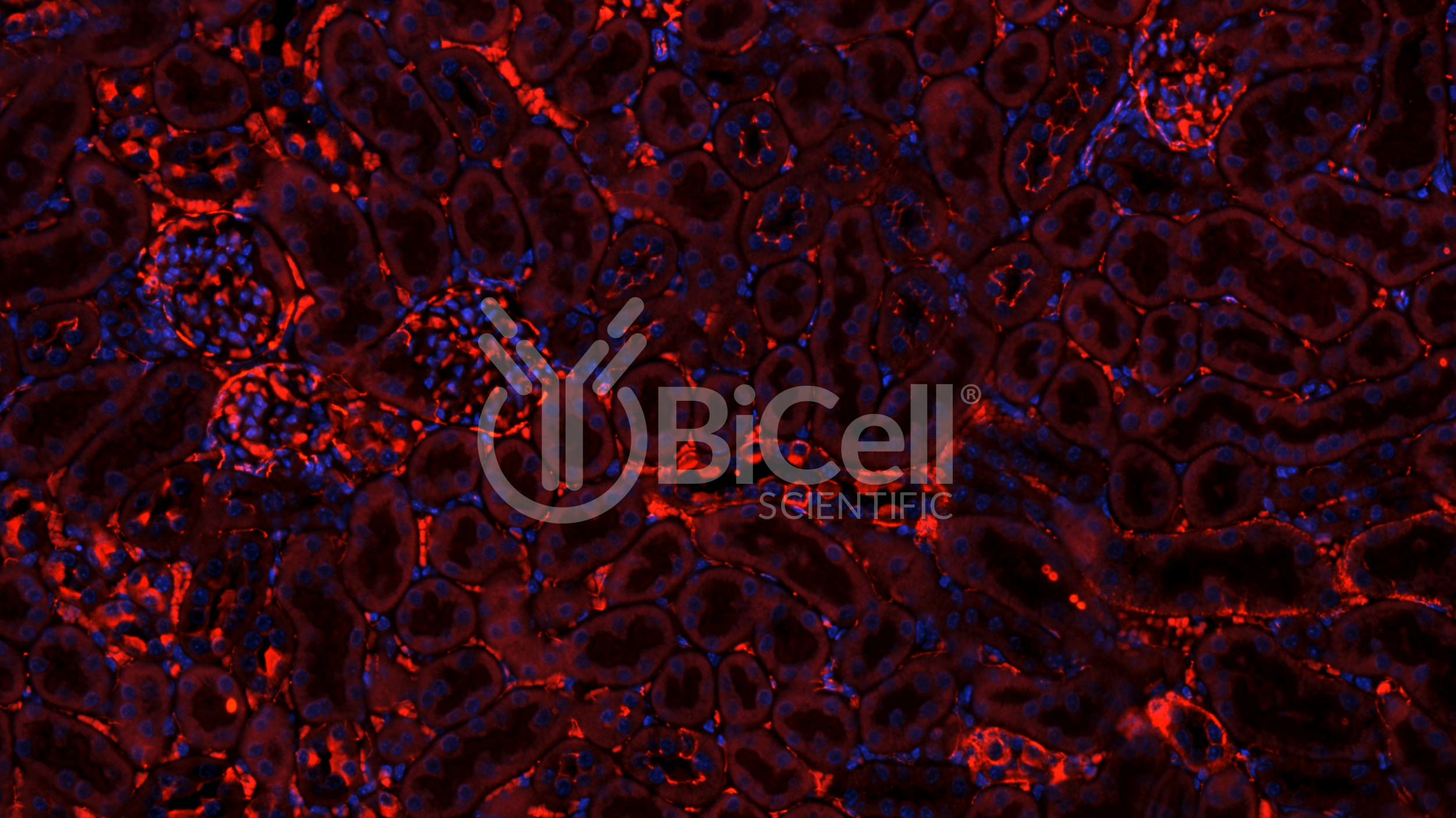 Claudin-1 (CLDN1) Antibody