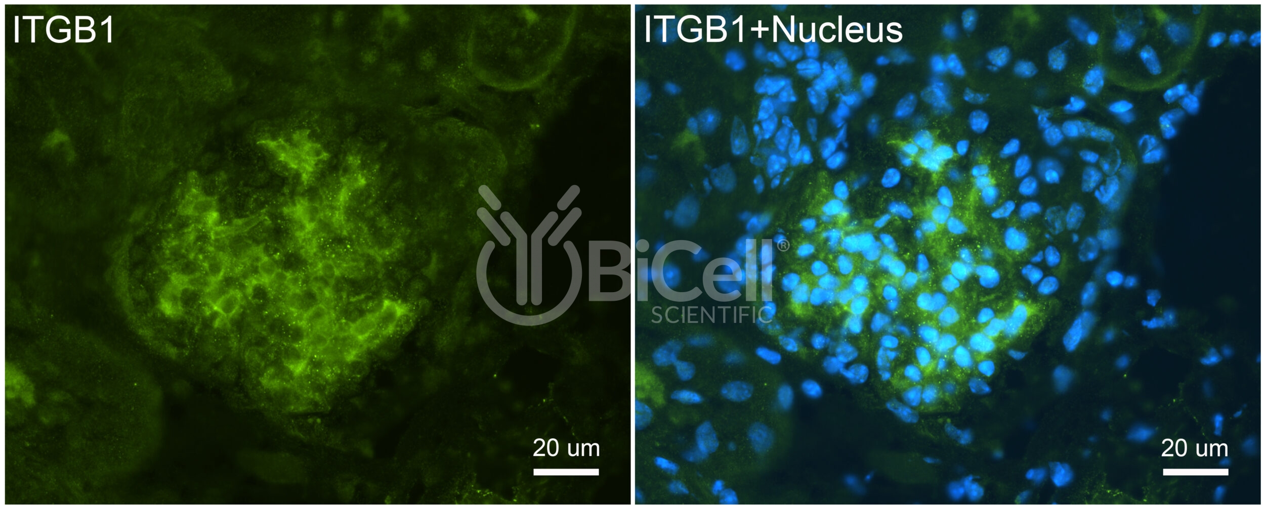 Integrin beta-1 (ITGB1 or CD29) Antibody
