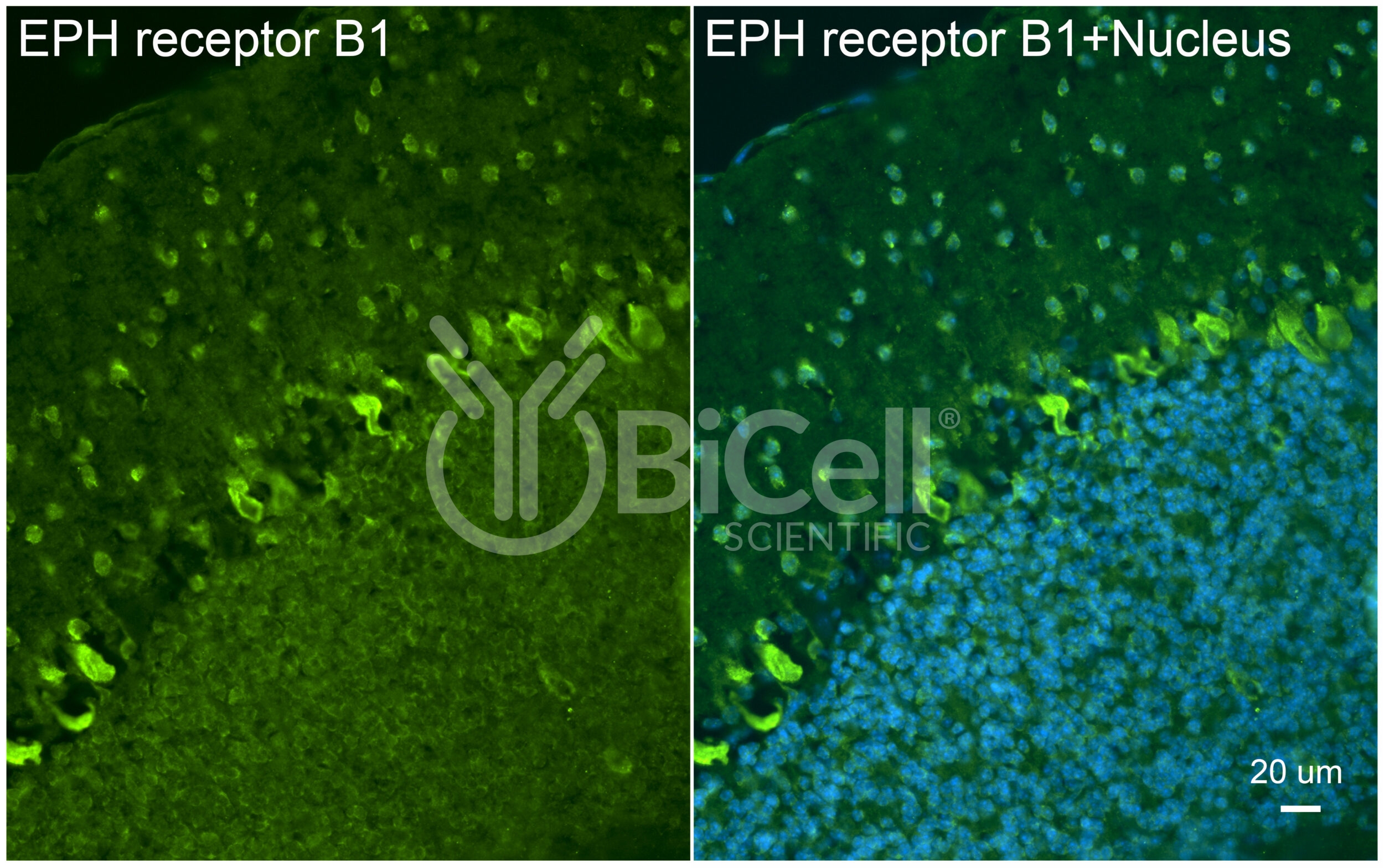 EPH Receptor B1 (EPHB1) Antibody