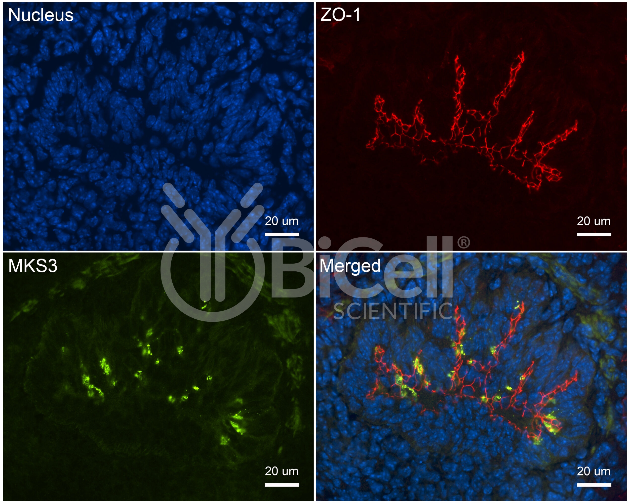 MKS3 (NPHP11 or Meckelin or TMEM67) Antibody