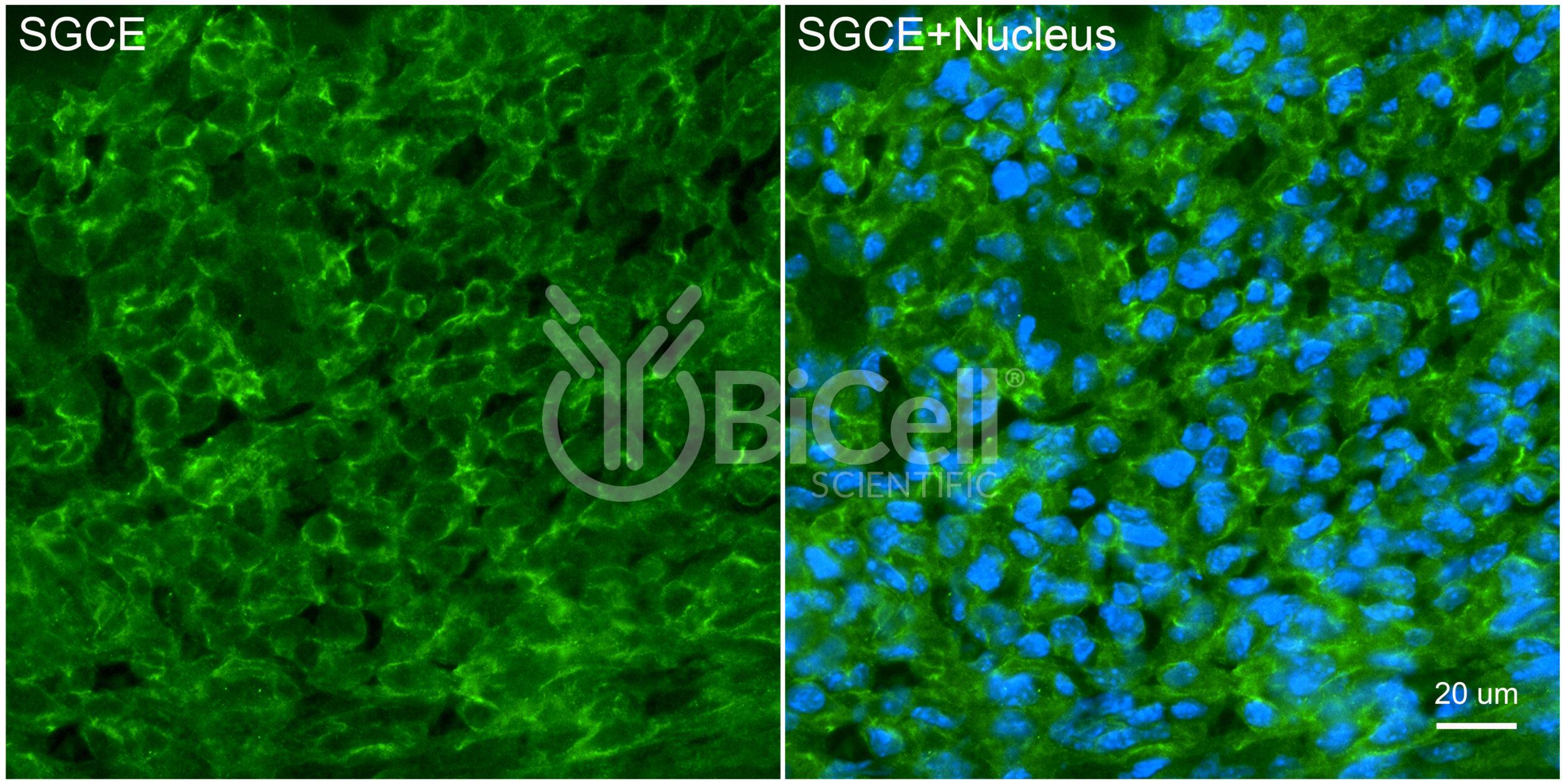 Sarcoglycan Epsilon (SGCE) Antibody