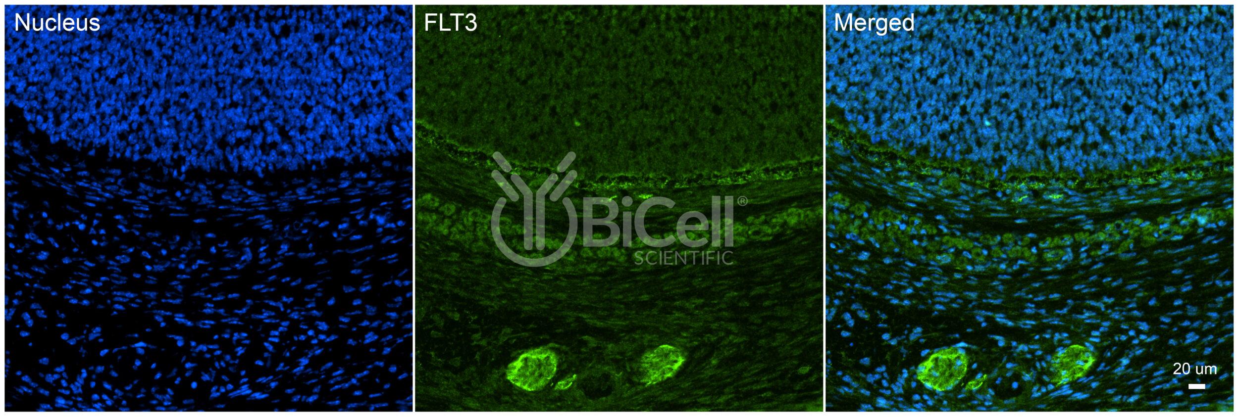 FLT3 (FLK2 or STK1 or CD135) Antibody