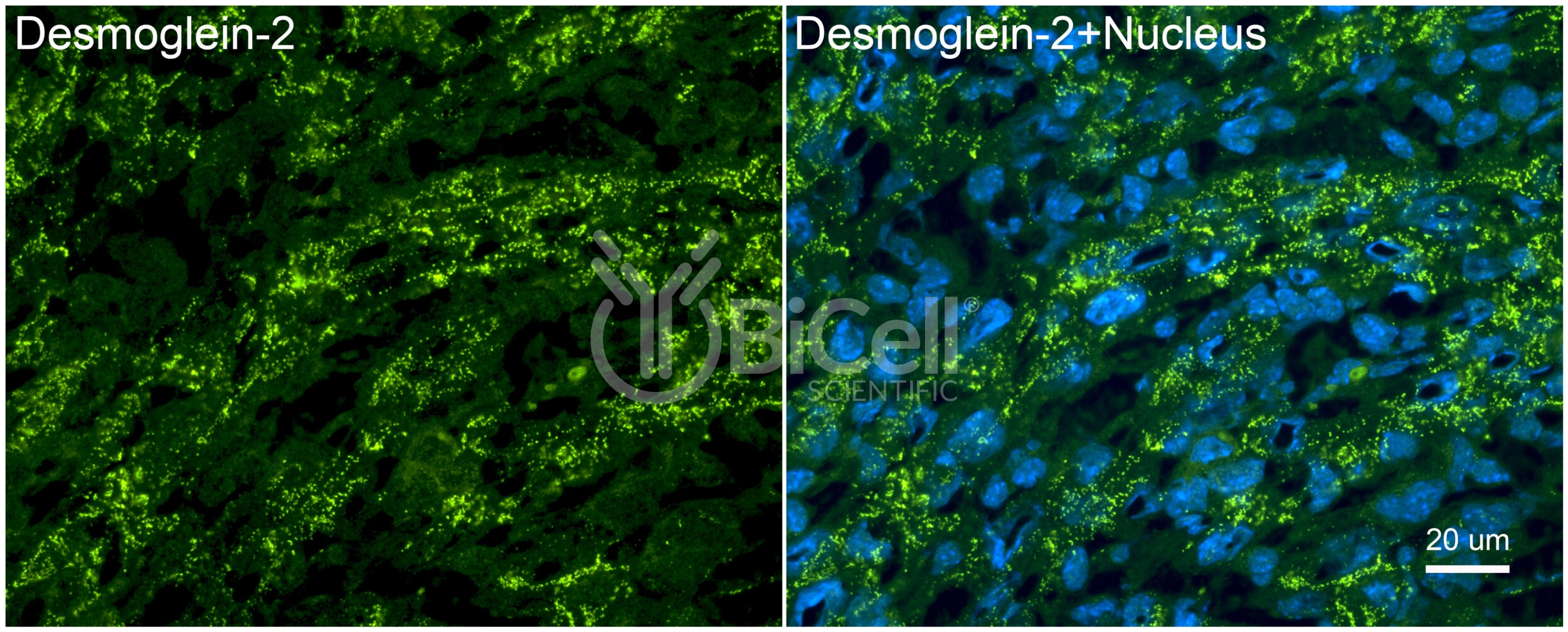 Desmoglein-2 (DSG2) Antibody