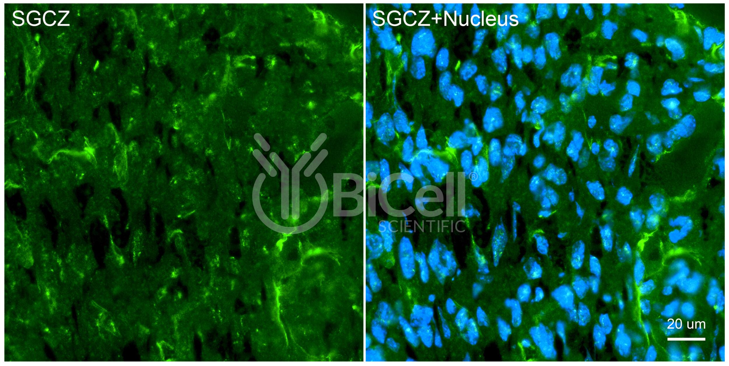 Sarcoglycan Zeta (SGCZ) Antibody