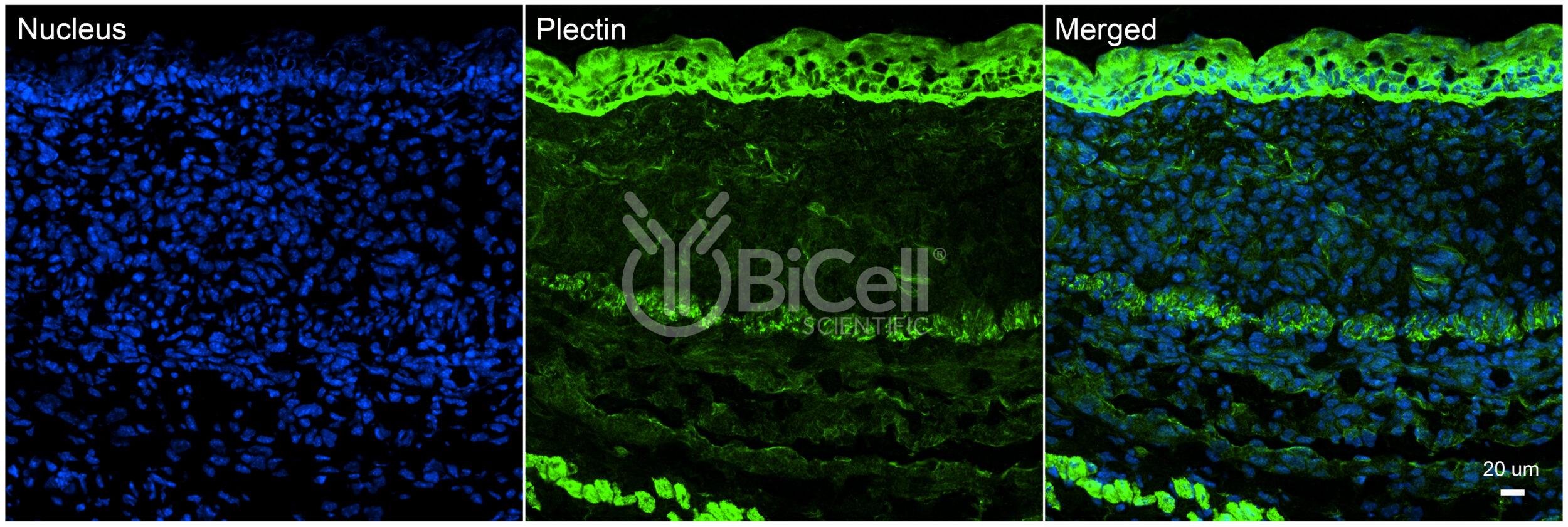 Plectin (PLEC) Antibody