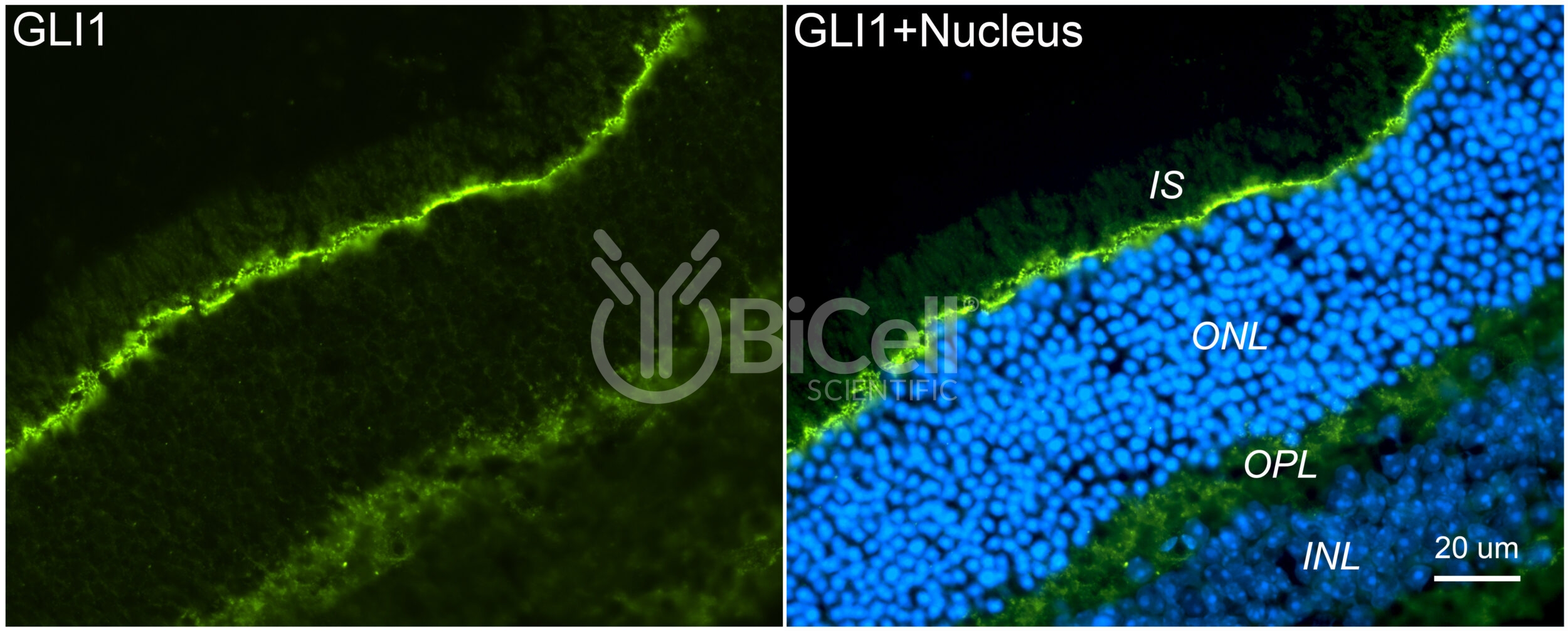 GLI1 Antibody