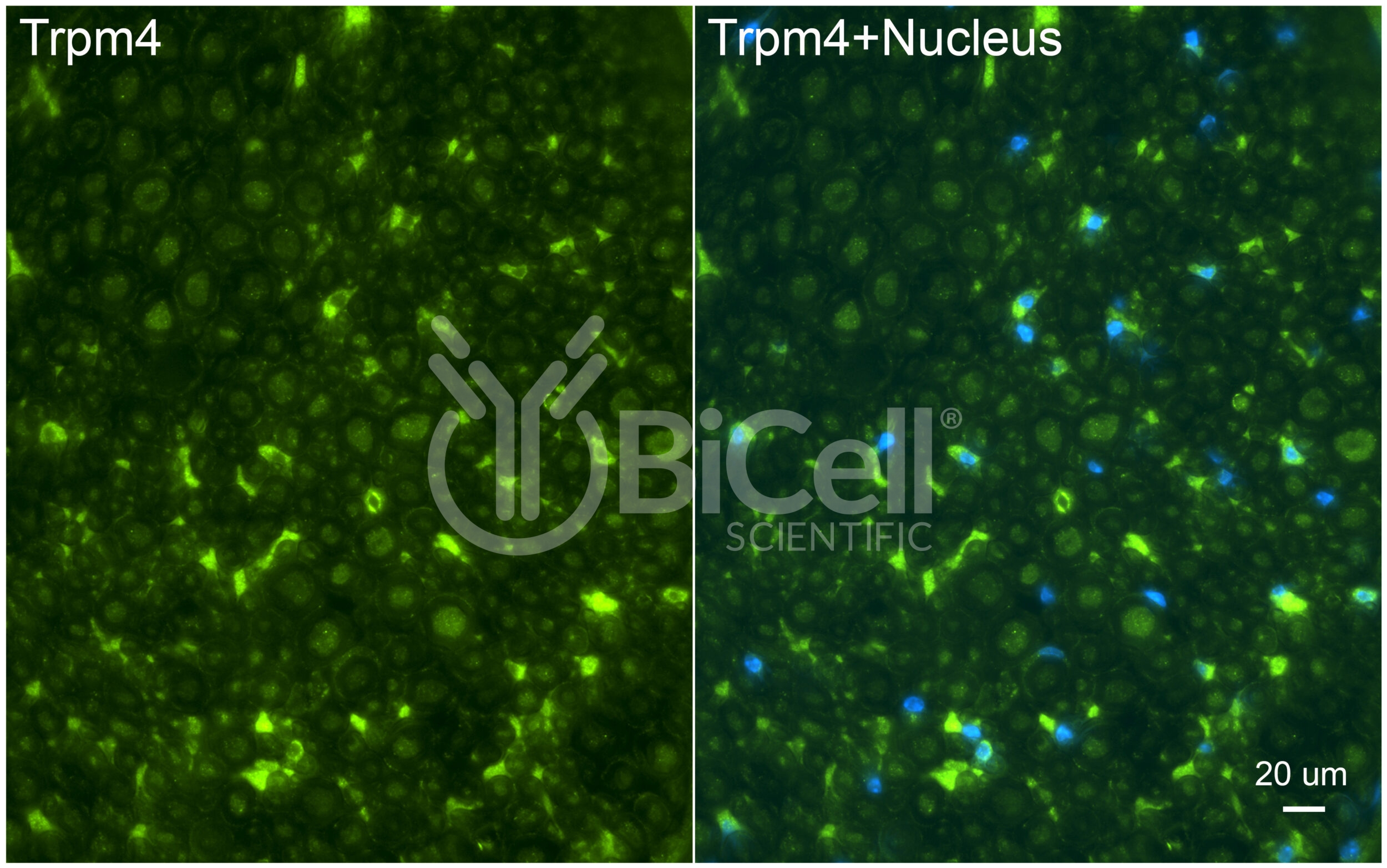 Trpm4 Antibody