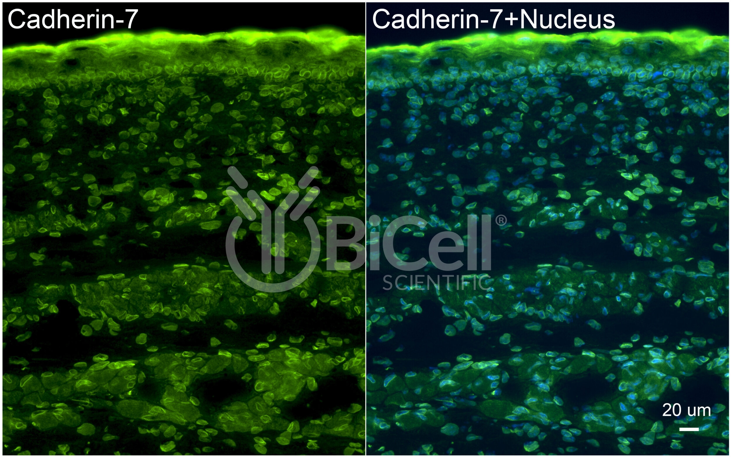 Cadherin-7 (CDH7) Antibody