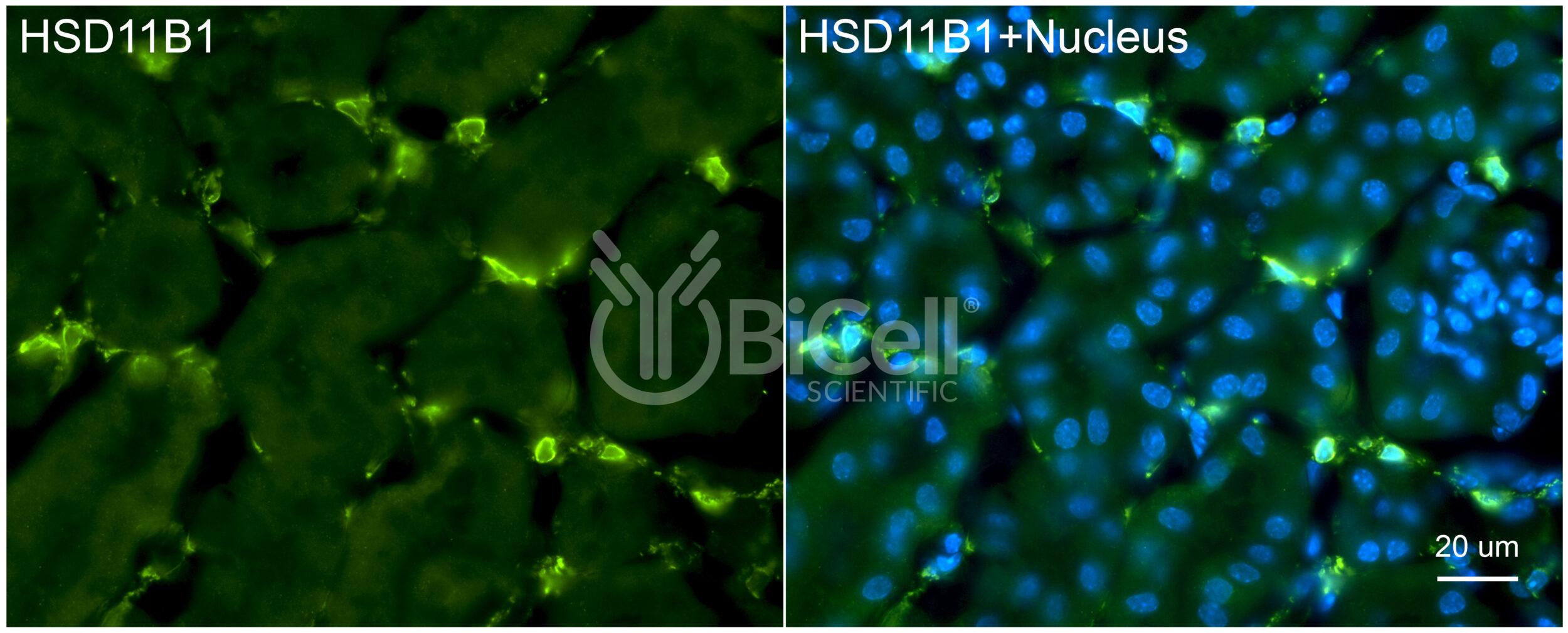 11-beta-HSD1 (HSD11B1) Antibody