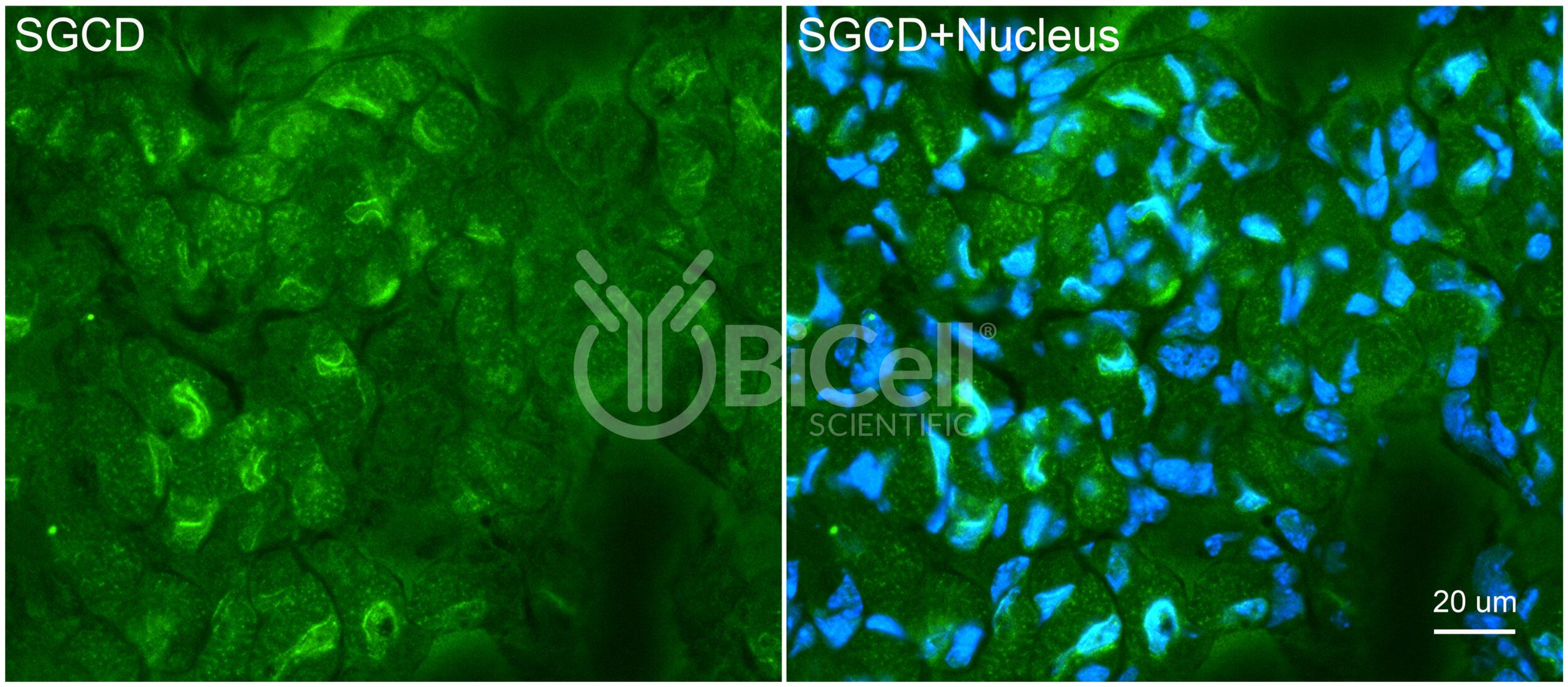 Sarcoglycan Delta (SGCD) Antibody