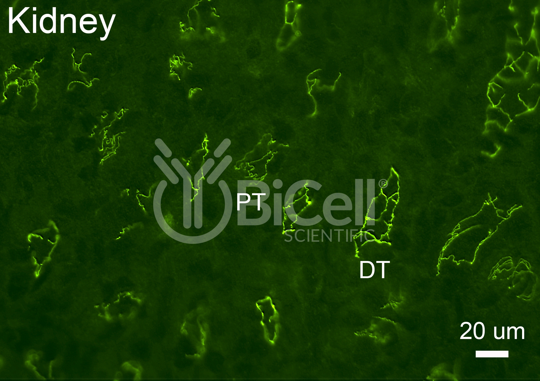 Cingulin (CGN) Antibody