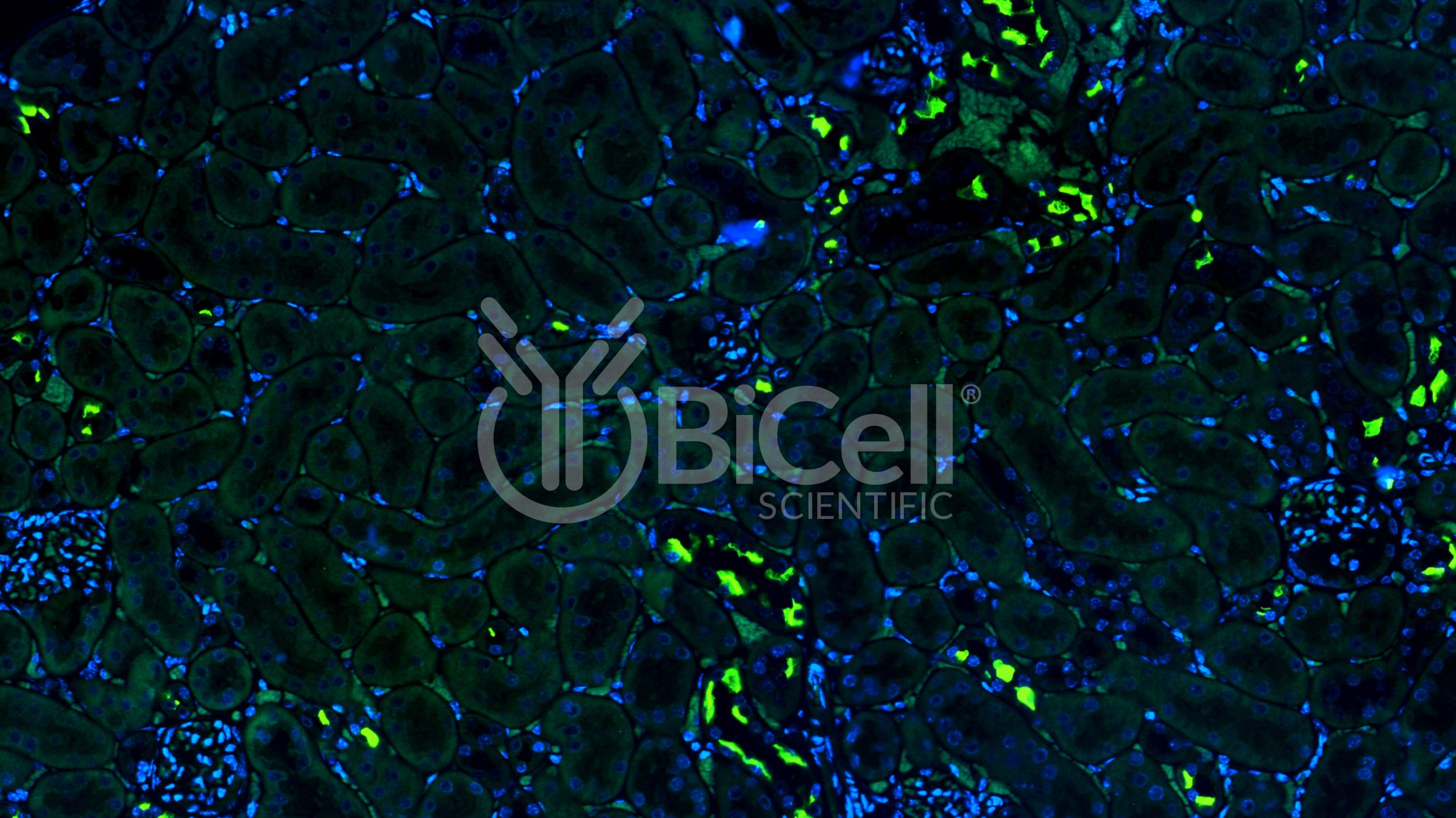 Pendrin (Slc26a4) Antibody