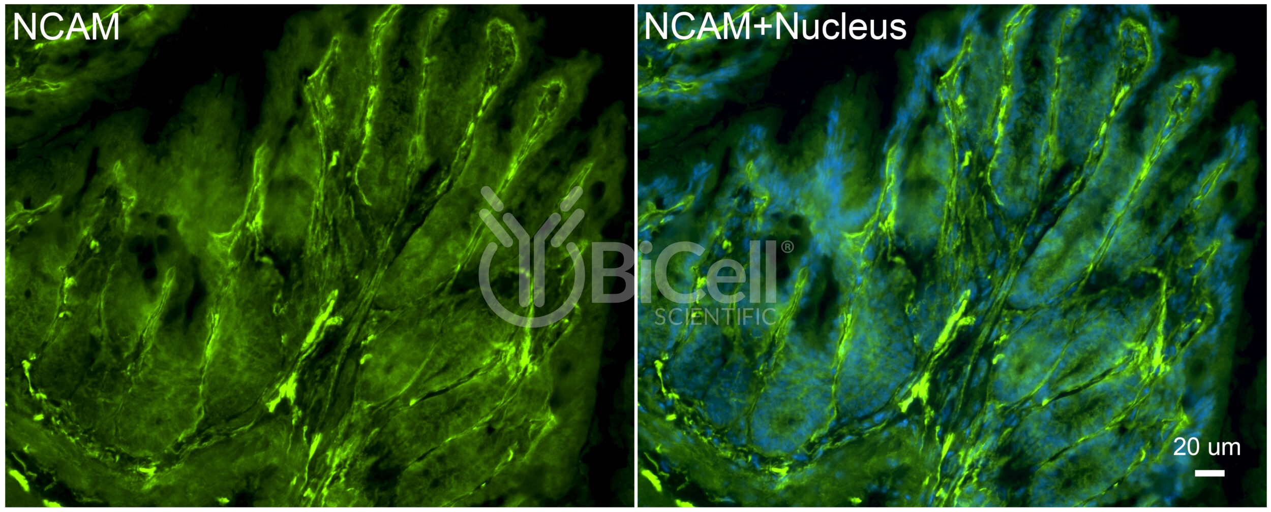 NCAM (CD56) Antibody